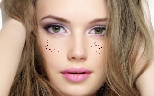 2023年西寧有哪些醫(yī)療整形醫(yī)院能夠有效去除眉間紋？權(quán)威推薦十家！