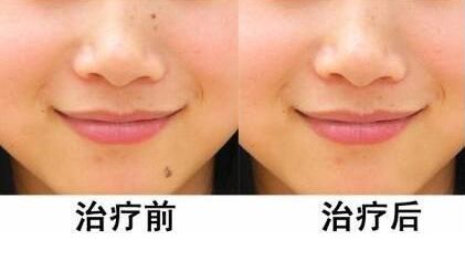 上海私密整形哪家好？專業(yè)推薦來自實(shí)際經(jīng)驗(yàn)的最佳選擇