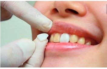 石家莊哪家整形醫(yī)院的雙眼皮割得好？醫(yī)生技術(shù)和審美怎么樣？