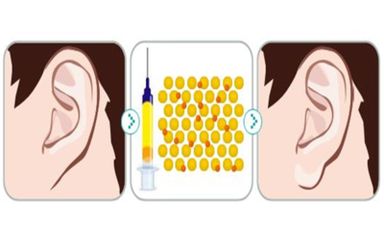 拉皮手術價格昂貴嗎？適合哪個年齡段的人做？