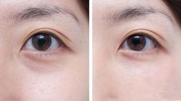 福州射頻除皺醫(yī)院哪家口碑好？