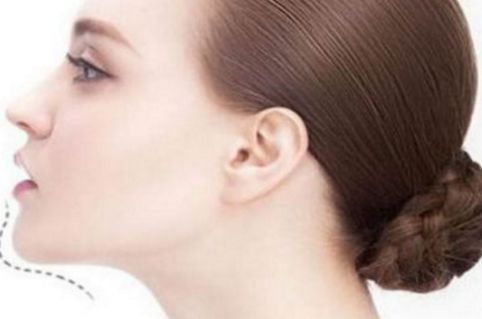 徐州吸脂減肥哪家醫(yī)院好？科學指導下，找到適合你的徐州吸脂減肥醫(yī)院