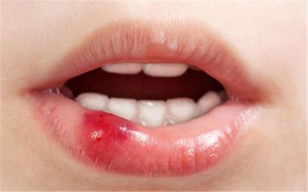 鄭州疤痕修復(fù)醫(yī)院人氣榜單：前十強(qiáng)口碑推薦