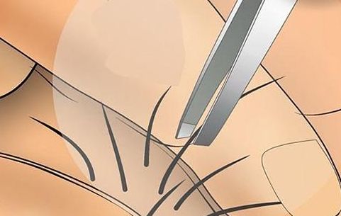 廣東整形哪家整形醫(yī)院好？選對(duì)整容修復(fù)專家，讓您煥然重生