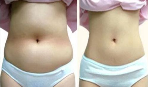 南京祛除雀斑醫(yī)院哪家好？南京專業(yè)祛除雀斑醫(yī)院排行榜分析