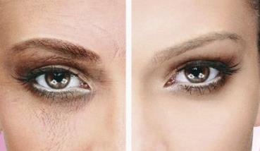 河北有哪些專業(yè)注射除皺醫(yī)院？2023河北領(lǐng)先的去皺醫(yī)院排行榜！