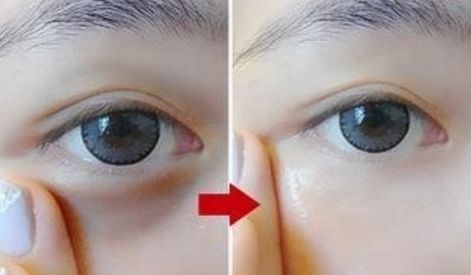 銀川雙眼皮手術(shù)哪家好？推薦2023年最受歡迎的銀川整形醫(yī)院