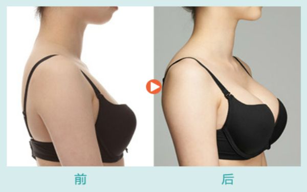 2023年濟南植發(fā)行業(yè)醫(yī)院對比，為你揭秘這幾家值得關注的機構