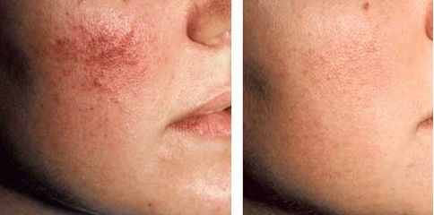 吉林市去疤醫(yī)院排名及評(píng)價(jià)，挑選最好的去疤醫(yī)院