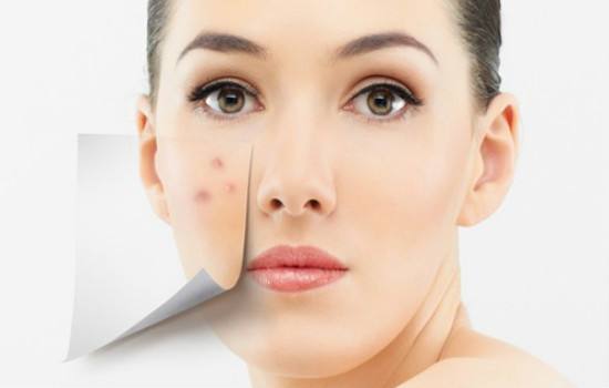 開外眼角前后效果如何？開眼角會留下疤痕嗎？