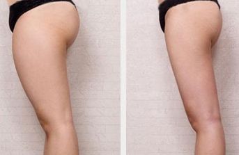 榆林哪家醫(yī)院治療疤痕好？綜合評估及專家推薦指南