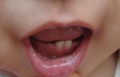 寧波熱瑪吉醫(yī)院哪家好？專業(yè)醫(yī)師團(tuán)隊(duì)、治療效果如何？