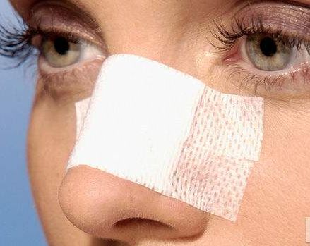 無(wú)錫哪家醫(yī)院去皺效果好？TOP醫(yī)院推薦，讓你擁有年輕青春的肌膚！