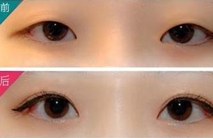 2023廈門(mén)美容整形醫(yī)院非常推薦！聲譽(yù)、信譽(yù)、實(shí)力俱佳！參考價(jià)格表鑒定，體驗(yàn)更佳！