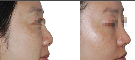 艾澤整容了嗎？探索明星整容的真相