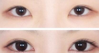 2023成都雀斑美白醫(yī)院排行榜更新！哪些整形美容醫(yī)院在口碑上名列前茅？