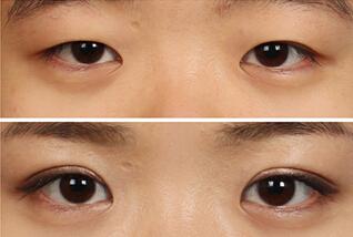 2023年濟(jì)南哪家醫(yī)院的PIP隆胸假體手術(shù)比較權(quán)威，排名前10強(qiáng)推薦！