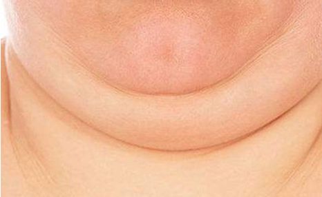 上海植發(fā)行業(yè)權(quán)威排行榜揭曉！哪家醫(yī)院更受贊譽(yù)？限時(shí)優(yōu)惠等你來(lái)！