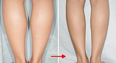 全國(guó)眼睛修復(fù)哪家醫(yī)院好？挑選最佳專家進(jìn)行眼睛修復(fù)服務(wù)