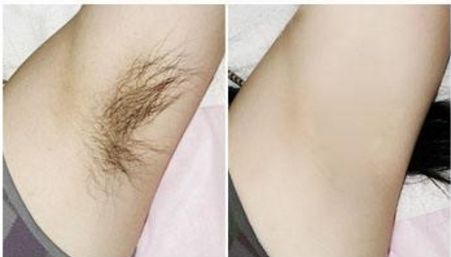 深圳哪家醫(yī)院去色斑好？我們?yōu)槟扑]權(quán)威專家團(tuán)隊(duì)。