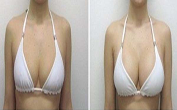 杭州疤痕磨削治療效果好的整形醫(yī)院有哪些？2023年杭州整形醫(yī)院疤痕磨削治療前十強(qiáng)排行揭曉！