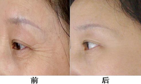 【2023濟(jì)南整形美容醫(yī)院哪家好？排名前十強(qiáng)榜單公布！】