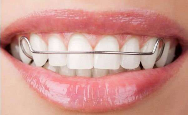 襄陽哪家整形醫(yī)院的雙眼皮效果好？