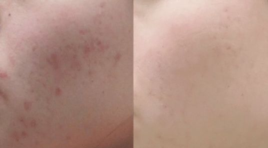 廣州整下巴哪家醫(yī)院好？廣州整下巴的正規(guī)醫(yī)院有哪些？