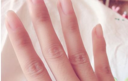 上海哪家醫(yī)院是最佳整形治療中心【闡述這些】