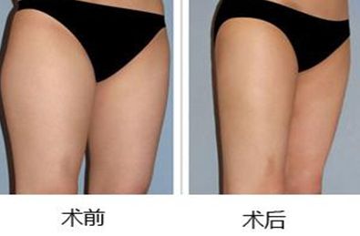 西安市除疤醫(yī)院排名及評(píng)價(jià)，哪家好？