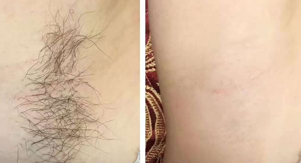 荊門市哪家美容整形醫(yī)院口碑好、技術(shù)精湛？