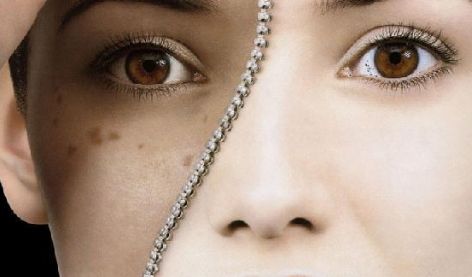 上海去疤最好的美容醫(yī)院有哪些？