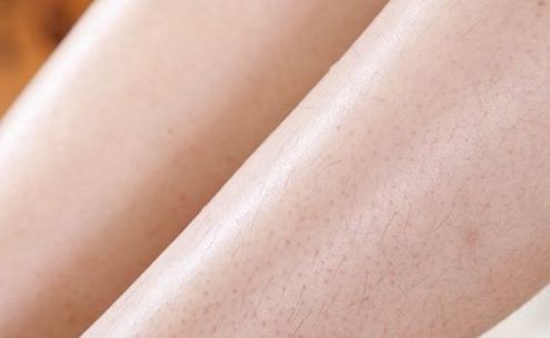 深圳微整形醫(yī)院綜合測評，哪家好？