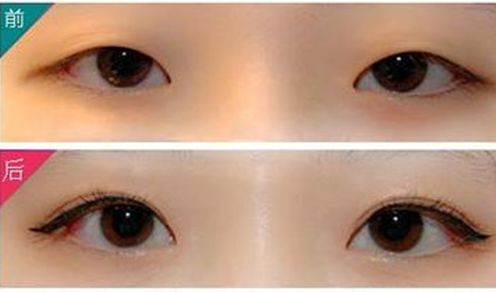 威海哪家正規(guī)激光祛斑機(jī)構(gòu)口碑好？