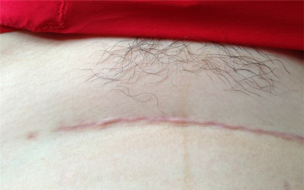 果酸換膚美容時，有哪些必備產(chǎn)品？