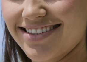 揭秘武漢眼綜合整形醫(yī)院哪家好？專家推薦+患者口碑評價(jià)