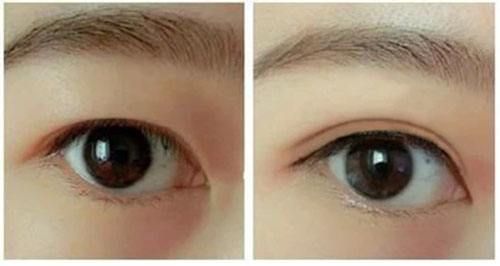 武漢綜合整形醫(yī)院2023年綜合隆鼻排行榜出爐！達(dá)哥拉斯綜合整形醫(yī)院技術(shù)比拼！