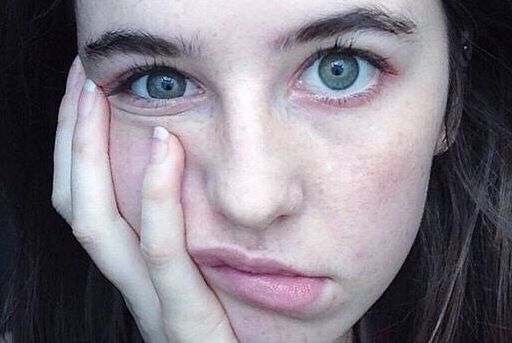 濟(jì)南祛斑正規(guī)醫(yī)院排名及評(píng)價(jià)如何？