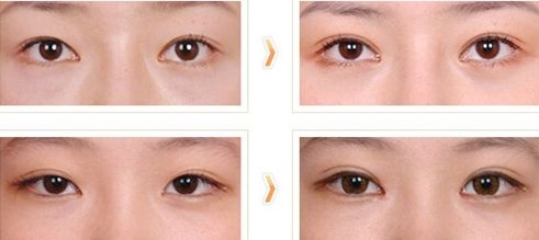 西安醫(yī)院激光祛疤，用戶夸贊不斷！技術(shù)高超，信譽(yù)卓越！