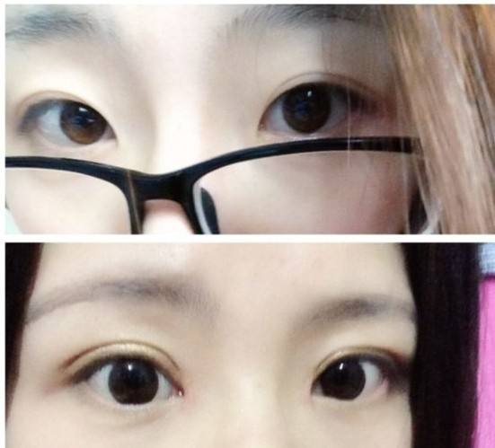 2023長沙很受歡迎的電波拉皮整形醫(yī)院排行榜出爐！揭秘十大皮膚松弛改善醫(yī)院