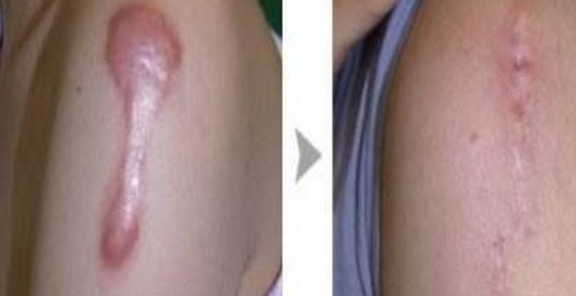 誰來管梁振倫的整容傳聞？現(xiàn)實(shí)與猜測(cè)交織