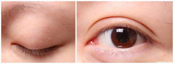 廣州華美美容整形醫(yī)院的整形效果好嗎？在哪里？地址簡(jiǎn)介+2023價(jià)格表一覽