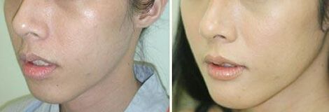 今年流行的減肥藥有哪些？吃過(guò)的減肥藥是否存在安全風(fēng)險(xiǎn)？