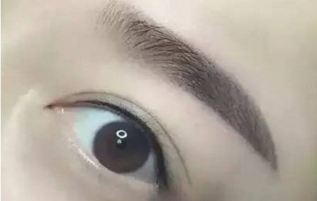 蘇州去除雀斑哪家醫(yī)院好？專業(yè)推薦蘇州市內(nèi)最優(yōu)質(zhì)的雀斑治療醫(yī)院