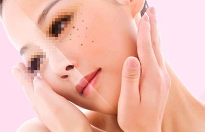 寧波哪家醫(yī)院祛痘效果好？