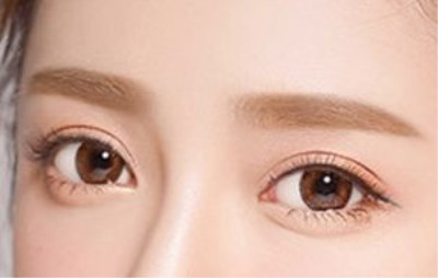 面部外傷疤痕是否能通過激光醫(yī)療技術(shù)進(jìn)行修復(fù)？