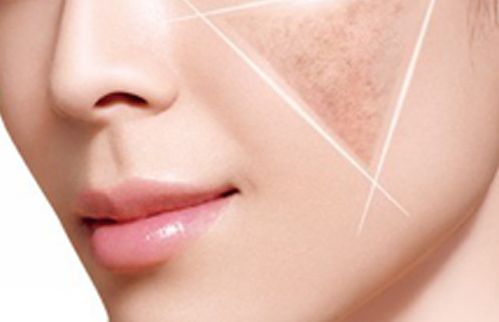 南寧哪家整形醫(yī)院鼻子整形效果好？