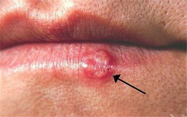 淮北正頜手術(shù)有哪些醫(yī)院可以信賴？哪家醫(yī)院的正頜手術(shù)效果好呢？