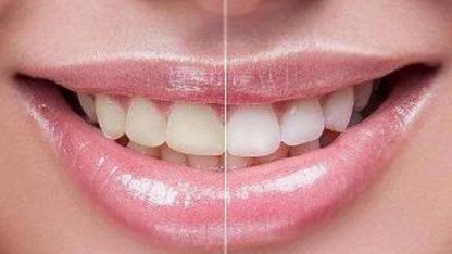 成都乳頭再造術(shù)醫(yī)院排名及費(fèi)用對(duì)比-選擇最適合自己的專(zhuān)業(yè)醫(yī)院