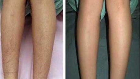 南京哪家下巴整形醫(yī)院好？南京下巴整形醫(yī)院排名前幾位